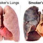 In 2009, Mia Washington gave birth to twins with two different fathers, a one-in-a-billion occurrence