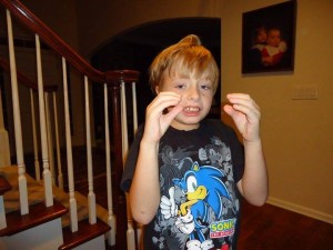 estereotipia-300x225.jpg.pagespeed.ce.zO4ZHewltd