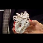 A two-year-old girl who was born with a serious heart defect has had a life-saving operation thanks to a 3D printer